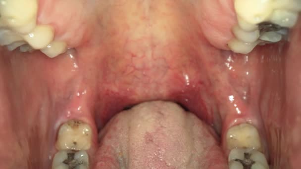 Mouth full of cavities, moving tongue and uvula — Stock Video