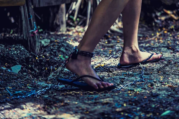 Fußverletzung von Frauen mit Venenödem mit hängendem Metall-Chai — Stockfoto