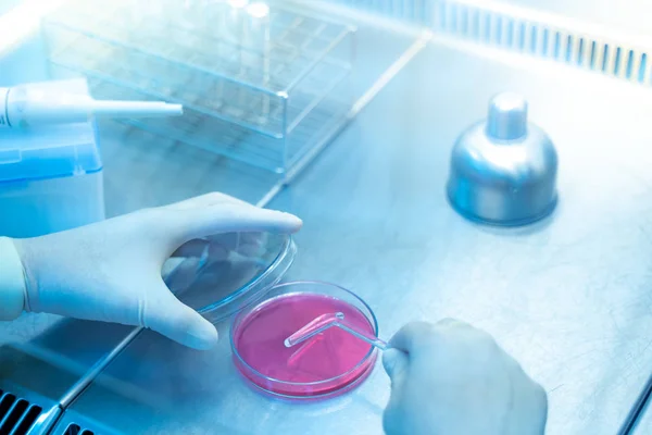 Mãos de cientistas estão fazendo pesquisas sobre bactérias em placas de geléia, testes laboratoriais para infecção, crescimento de bactérias gram-negativas, vírus, novos germes, pesquisa para a produção de vacinas. . — Fotografia de Stock