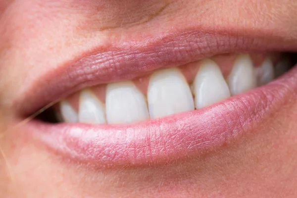 Улыбка счастливой женщины со здоровыми белыми зубами — стоковое фото