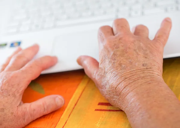 Alter gefleckte Hände auf dem Laptop — Stockfoto