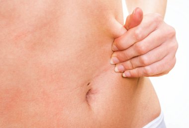 Karnı kadın kıstırma deri kapatmak