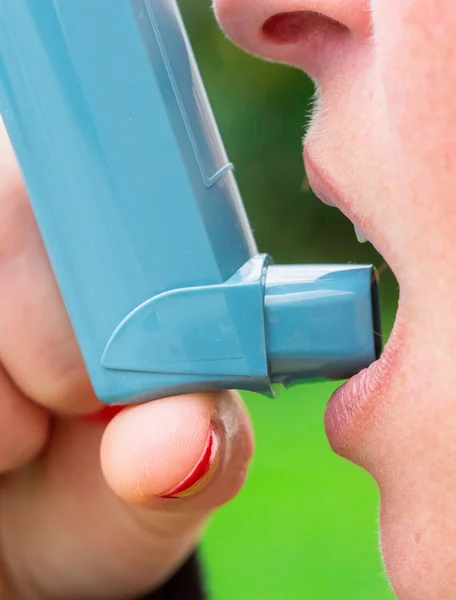 Primer plano de la mujer con aerosol de asma —  Fotos de Stock