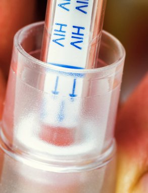 Kendi kendini sınama kan içinde HIV tutan el