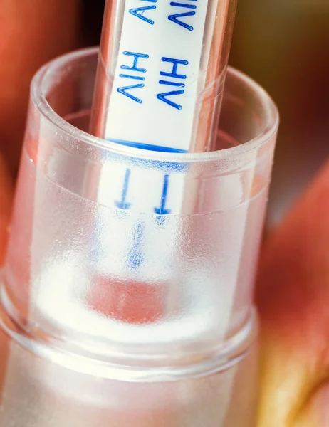 Hand hält Hiv-Selbsttest mit Blut drin — Stockfoto