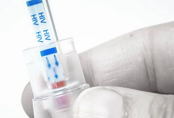 Hand holding HIV self-test with blood inside — Stock Photo, Image