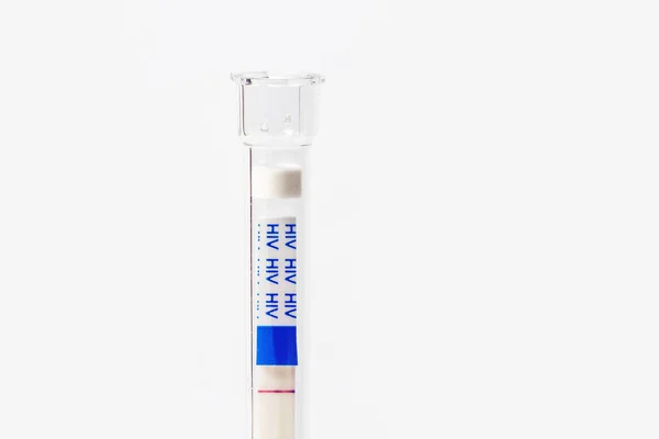 Focus on an HIV self-test with seronegative result — Stock Photo, Image