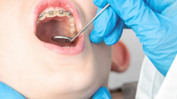 Primo Piano Del Dentista Con Uno Strumento Visualizzare Denti Paziente — Foto Stock