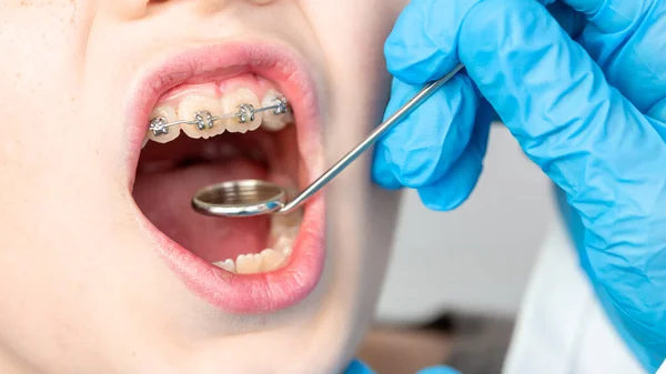 Zbliżenie Dentysty Pomocą Przyrządu Wizualizacji Zębów Dziecka Pacjenta — Zdjęcie stockowe