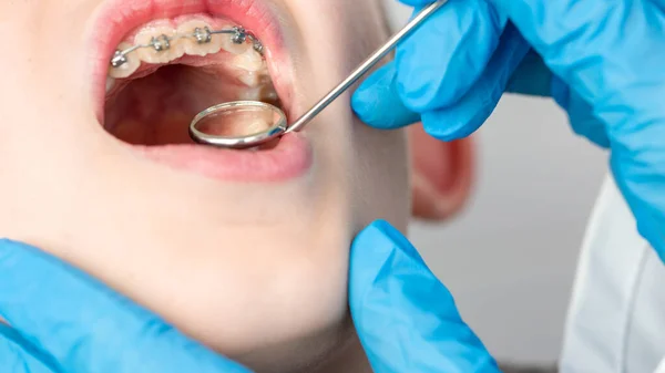 Closeup Dentist Using Instrument Visualize Teeth Child Patient Focus Mirror — Stock Photo, Image