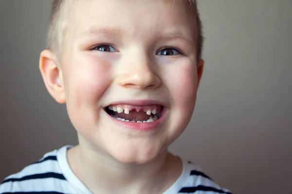 小男孩微笑着 露出了他第一颗丢失的乳汁 合上了肖像 儿童保健 健康的改变牙齿概念 — 图库照片