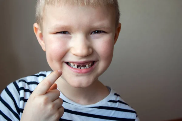 Rapaz Sorrindo Mostrando Seu Primeiro Dente Leite Desaparecido Dentes Close — Fotografia de Stock