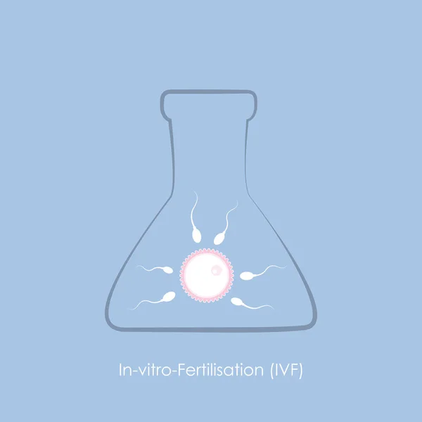 Reproducción de fertilidad de óvulos y espermatozoides FIV — Archivo Imágenes Vectoriales