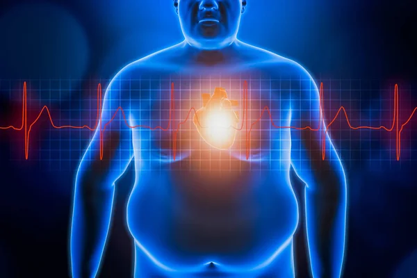 Tlusté nebo obézní mužské hrudní tělo se srdcem a červenou křivkou tepu srdce. Modrý futuristický hologram 3d vykreslující ilustraci. Obezita, zdravotní péče, zdravotní péče, wellness, koncepce srdečních onemocnění. — Stock fotografie