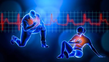 Obese of fat man kneeling while suffering from a heart attack 3d rendering illustration. STEMI heart rate EKG in the background and copy space. Medical and healthcare, myocardial infarction concept. clipart