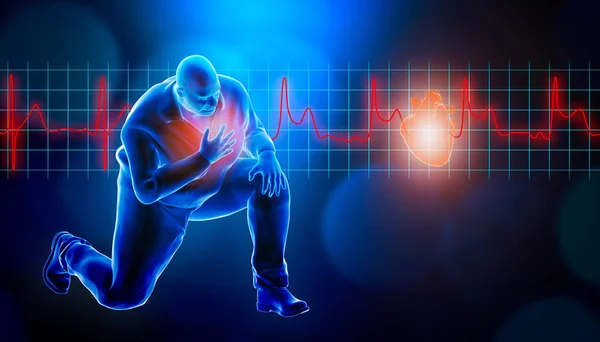 Obèses de gros homme agenouillé tout en souffrant d'une crise cardiaque 3d rendant illustration. Fréquence cardiaque STEMI EKG en arrière-plan et espace de copie. Médecine et santé, concept d'infarctus du myocarde . — Photo