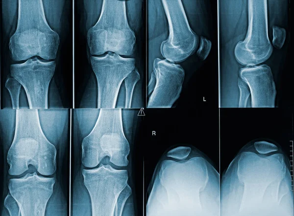 大人の男性膝X線画像異なる角度で.医学的解剖学的画像. — ストック写真