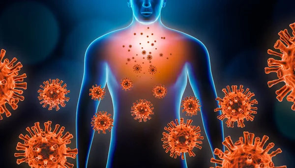 病毒性气管炎3D显示与红病毒细胞和人体的说明 结肠病毒19型 传染性和炎症性呼吸道疾病 如肺炎 支气管炎 铜的概念 — 图库照片