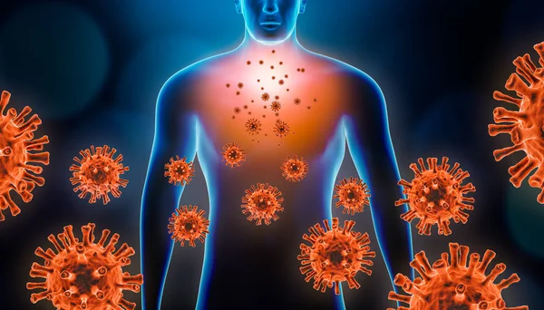 Viral pnömonit 3 boyutlu görüntüleme kırmızı virüs hücreleri ve insan vücudu. Coronavirus, covid 19, zatürree, bronşit, copd kavramları gibi bulaşıcı ve iltihaplı solunum hastalıkları.