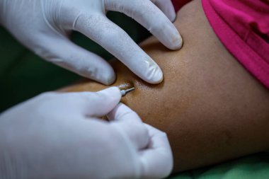 Hastane hasta kan ile enjekte edilir.