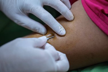 Hastane hasta kan ile enjekte edilir.