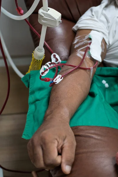 Переливання крові, діаліз — стокове фото