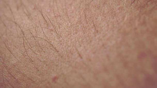 Close Skin Caucasian Hair Moles Macro Shot — Stock Video