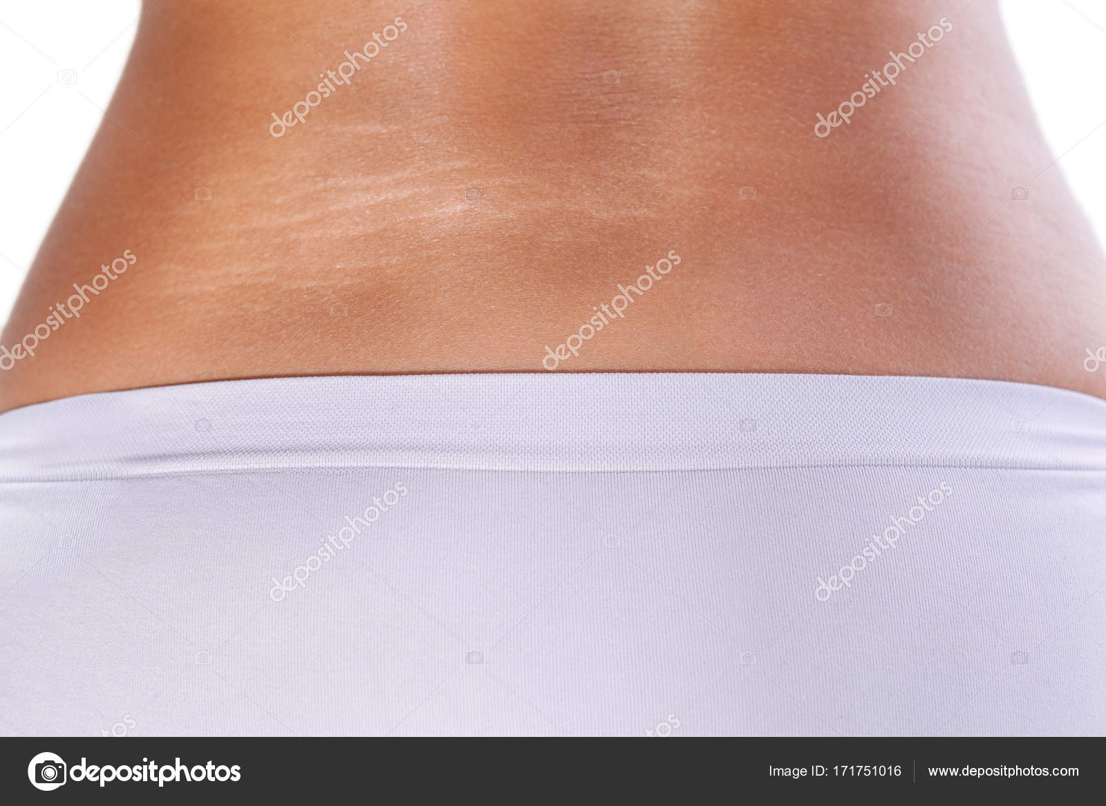 Cuerpo de mujer con estrías: fotografía de stock © cherriesjd