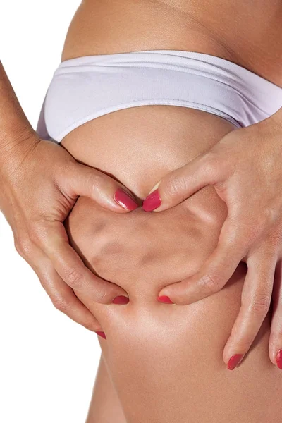 Celulitis mostrada en el muslo de las mujeres — Foto de Stock