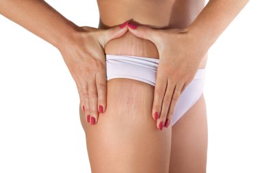 Woman examining her stretch marks clipart