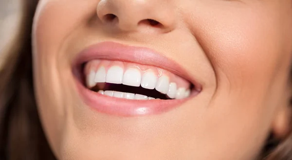 Smiling woman with healthy teeth — Stock Photo, Image