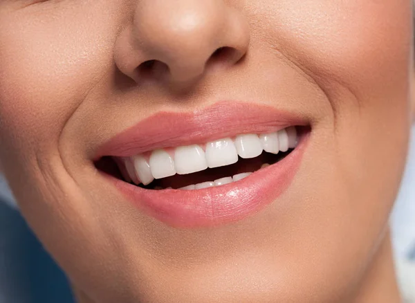 Close up of beautiful healthy smile — Stock Photo, Image