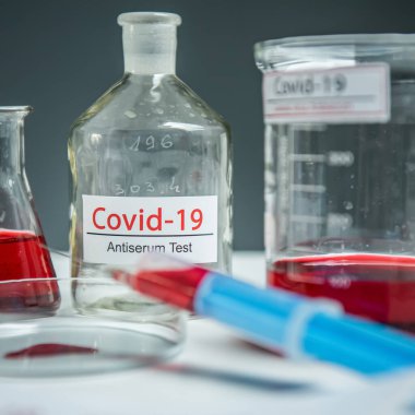 Coronavirus, Corona Virüsü laboratuarındaki masada bulunan numune tüpünde 19 enfekte kan örneği buldu.
