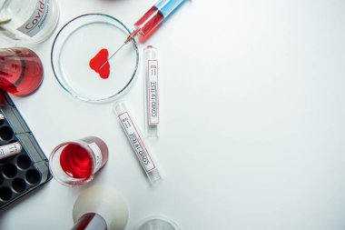 Coronavirus, Corona Virüsü laboratuarındaki masada bulunan numune tüpünde 19 enfekte kan örneği buldu.