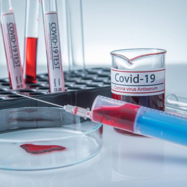 Coronavirus, Corona Virüsü laboratuarındaki masada bulunan numune tüpünde 19 enfekte kan örneği buldu.