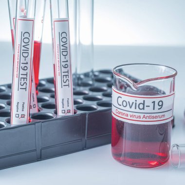 Coronavirus, Corona Virüsü laboratuarındaki masada bulunan numune tüpünde 19 enfekte kan örneği buldu.
