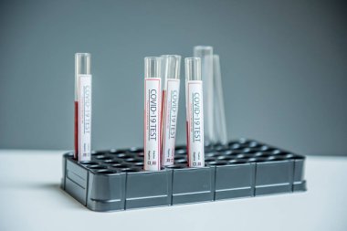 Coronavirus, Corona Virüsü laboratuarındaki masada bulunan numune tüpünde 19 enfekte kan örneği buldu.