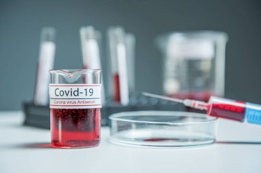 Coronavirus, Corona Virüsü laboratuarındaki masada bulunan numune tüpünde 19 enfekte kan örneği buldu.