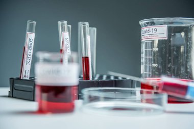 Coronavirus, Corona Virüsü laboratuarındaki masada bulunan numune tüpünde 19 enfekte kan örneği buldu.