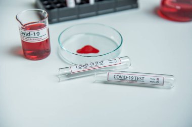 Coronavirus, Corona Virüsü laboratuarındaki masada bulunan numune tüpünde 19 enfekte kan örneği buldu.