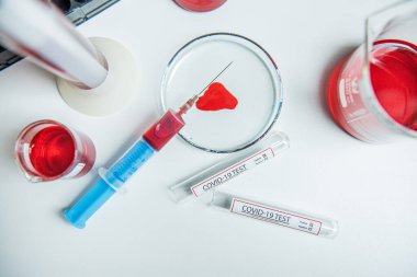 Coronavirus, Corona Virüsü laboratuarındaki masada bulunan numune tüpünde 19 enfekte kan örneği buldu.