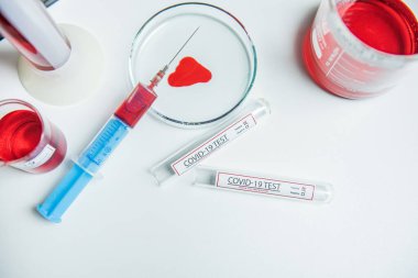 Coronavirus, Corona Virüsü laboratuarındaki masada bulunan numune tüpünde 19 enfekte kan örneği buldu.