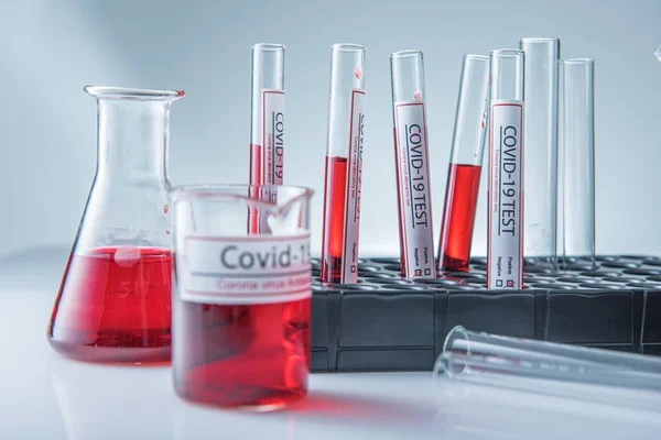 Coronavirus Covid19 Muestra Sangre Infectada Tubo Muestra Mesa Laboratorio Del — Foto de Stock