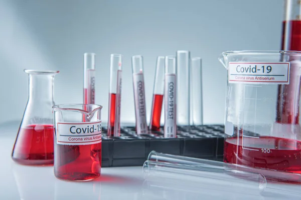 Coronavirus Corona Virüsü Laboratuarındaki Masada Bulunan Numune Tüpünde Enfekte Kan — Stok fotoğraf