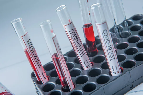 Coronavirus Covid19 Zakażona Próbka Krwi Probówce Stole Laboratorium Wirusa Korony — Zdjęcie stockowe