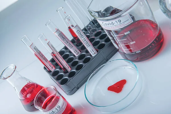 Coronavirus covid19 infected blood sample in sample tube on table in corona virus laboratory