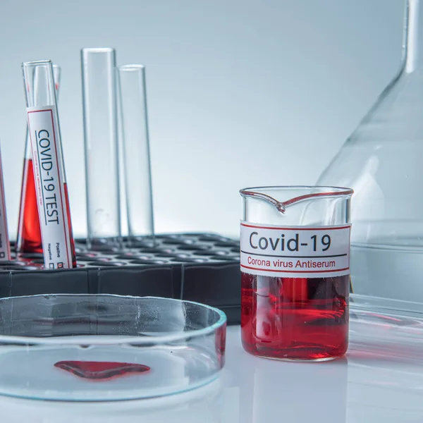 コロナウイルス検査室のテーブルの上のサンプルチューブに感染した血液サンプル19 — ストック写真
