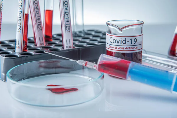 Coronavirus Covid19 Fertőzött Vérminta Corona Vírus Laboratóriumában Táblázat Mintatartójában — Stock Fotó