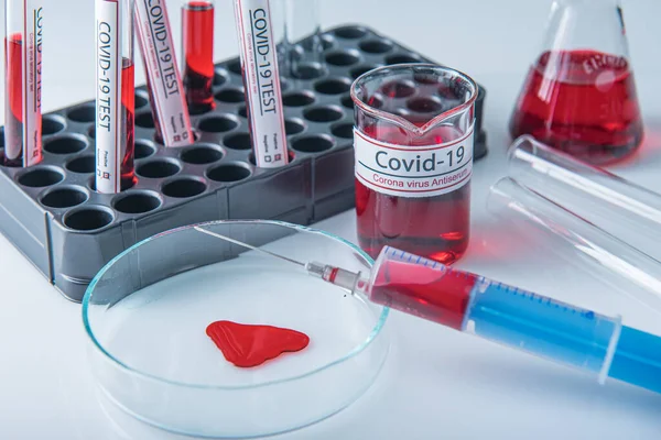 Коронавірус Ковід19 Заражений Зразком Крові Пробірці Столі Лабораторії Коронавірусу — стокове фото