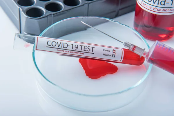 Coronavirus Covid19 Amostra Sangue Infectada Tubo Amostra Tabela Corona Vírus — Fotografia de Stock